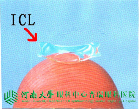 ICL植入術(shù)，高度近視患者的福音