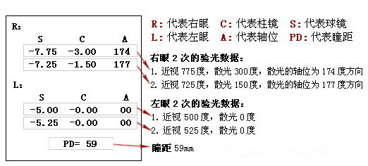 眼科醫(yī)生教你如何一分鐘看懂驗(yàn)光單！