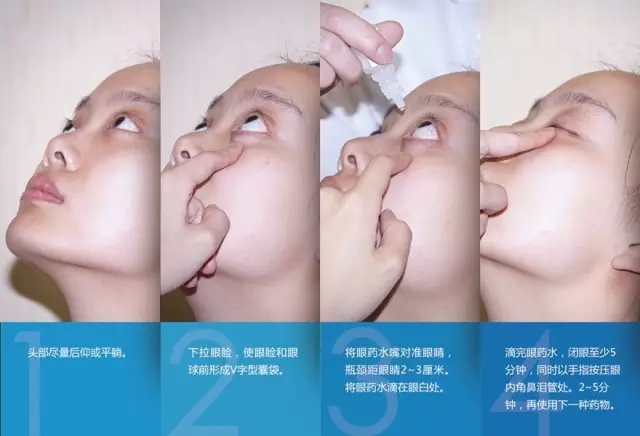 眼藥水你點(diǎn)對了嗎？快來看看！