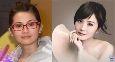 那些近視戴鏡暴丑的女明星們是做了什么變美了？？？